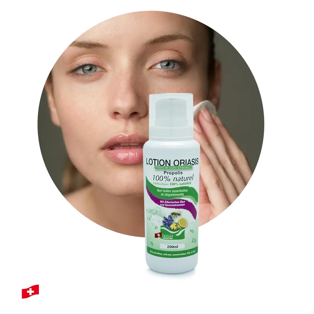 lotion oriasis